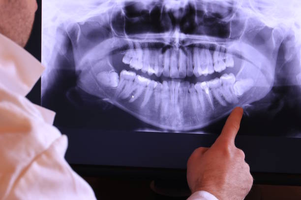 Best Broken Tooth Emergency  in Baltic, CT